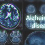 Urgent WARNING — Brain Pollution Crisis Uncovered MRI brain scan highlighting Alzheimer's disease