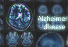 Urgent WARNING — Brain Pollution Crisis Uncovered MRI brain scan highlighting Alzheimer's disease