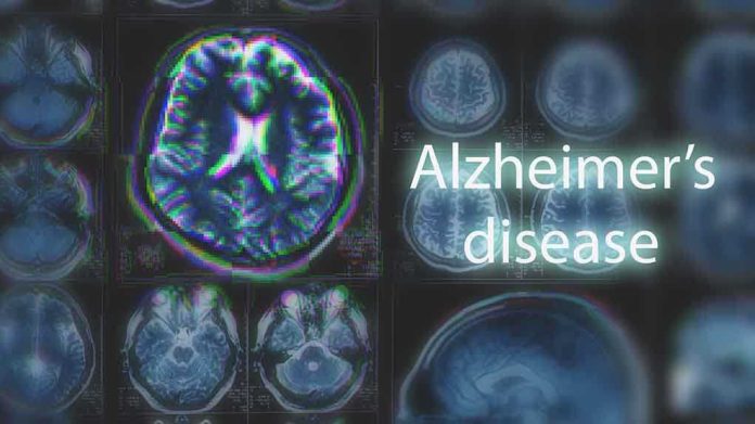 MRI brain scan highlighting Alzheimer's disease