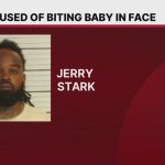 Baby Bitten By Father In Horrible Attack Baby Bitten By Father In Horrible Attack