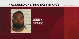 Baby Bitten By Father In Horrible Attack Baby Bitten By Father In Horrible Attack