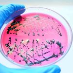 Deadly Bacteria STILL Lurks — YET, City Declares “All Clear” Gloved hand holding petri dish with bacterial colonies on pink agar