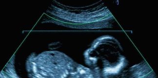Oldest Embryo? Not The Wildest Part Fetal ultrasound scan image